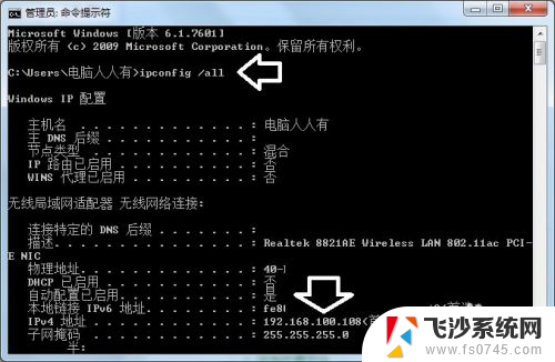 电脑添加ip地址 IP地址增加技巧